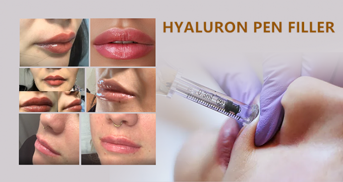 inyecciones ácidas hialurónicas ácidas hialurónicas de los llenadores del labio de los llenadores para el tratamiento 2 de la pluma y de la micro-aguja